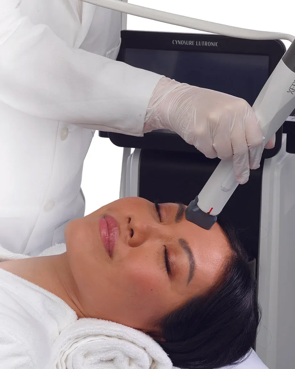 XERF skin tightening treatment at GLOW by Elena Reitman MD