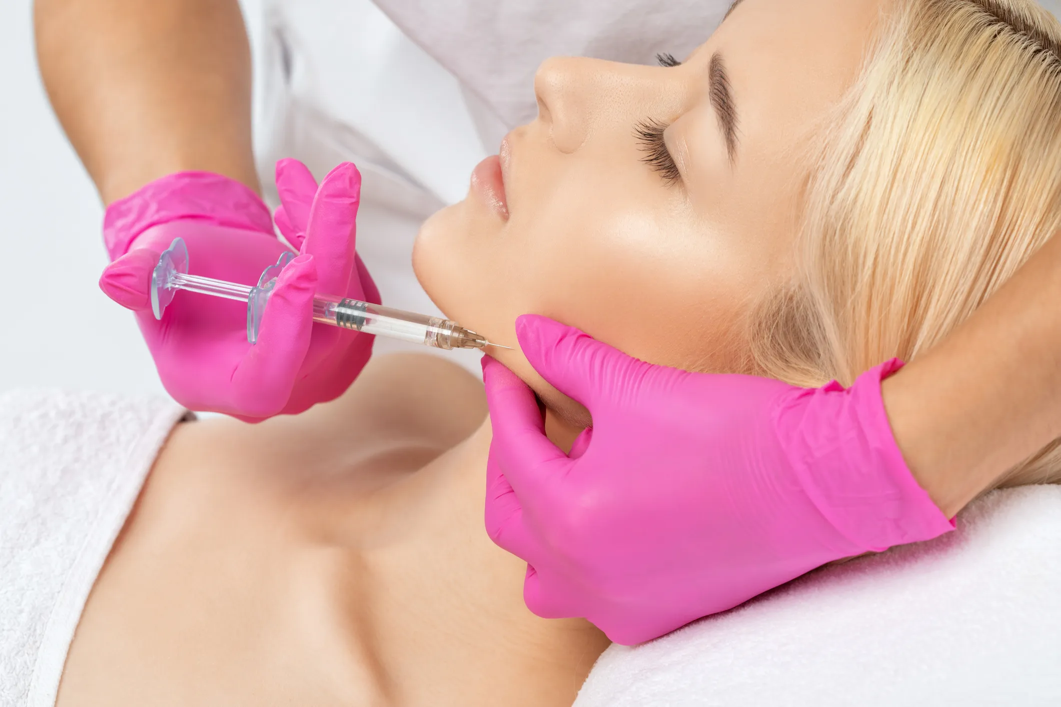 Radiesse treatment at GLOW by Elena Reitman MD