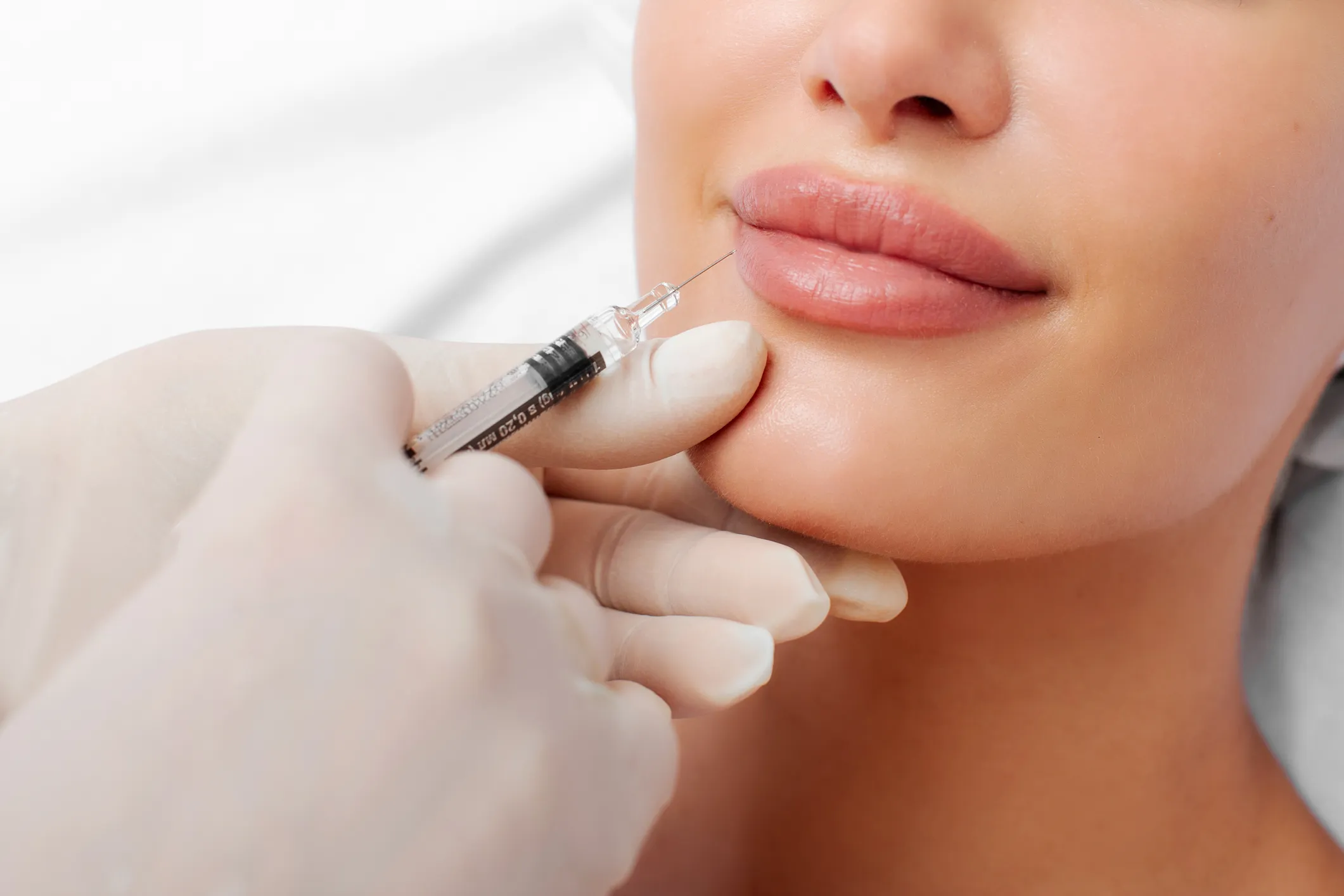 Lip Fillers treatment at GLOW by Elena Reitman MD