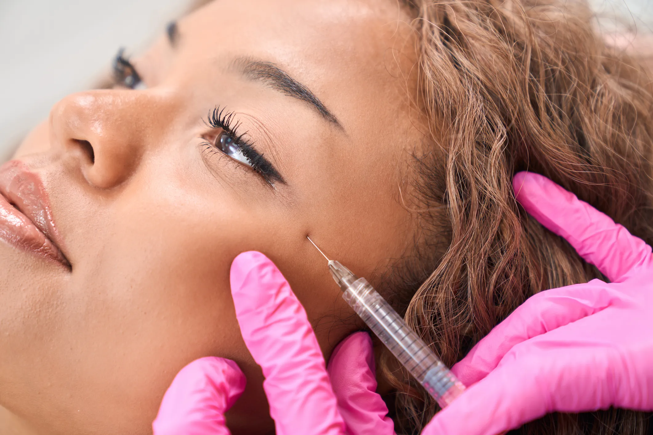 Sculptra treatment at GLOW by Elena Reitman MD