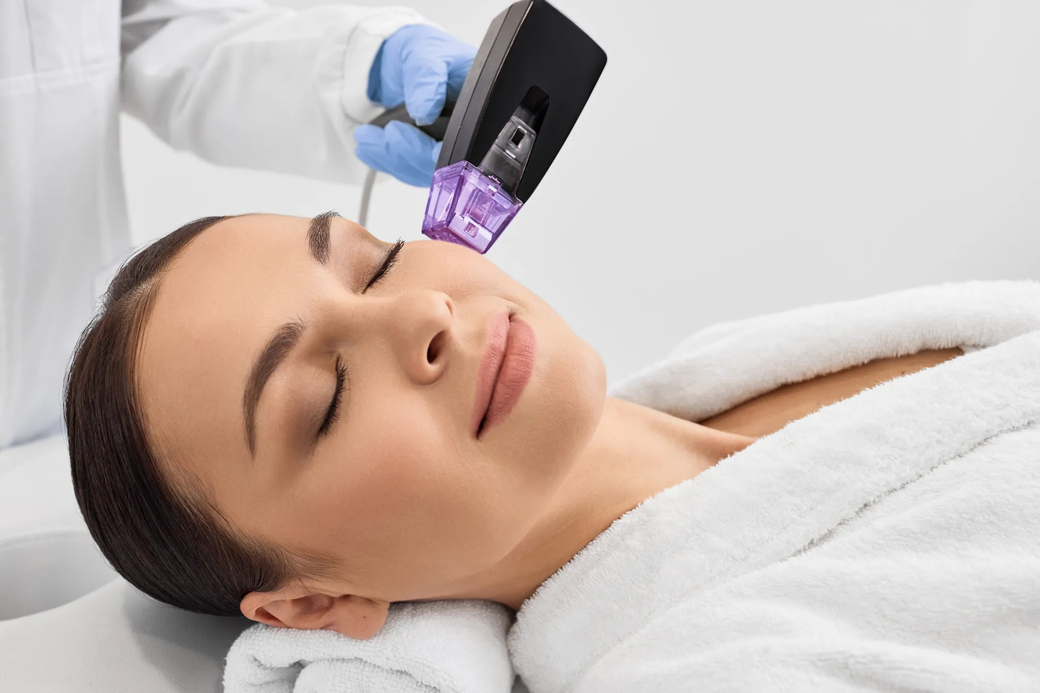 Secret Rf Microneedling treatment at GLOW by Elena Reitman MD
