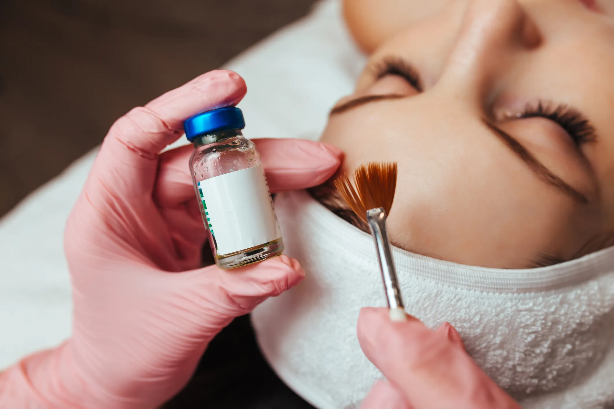 Chemical Peels treatment at GLOW by Elena Reitman MD