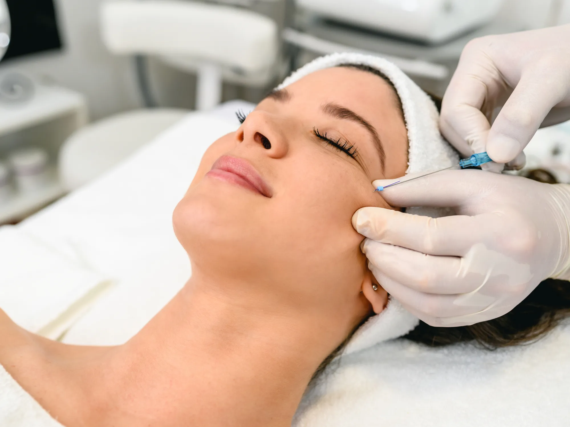 Pdo Thread Lift treatment at GLOW by Elena Reitman MD